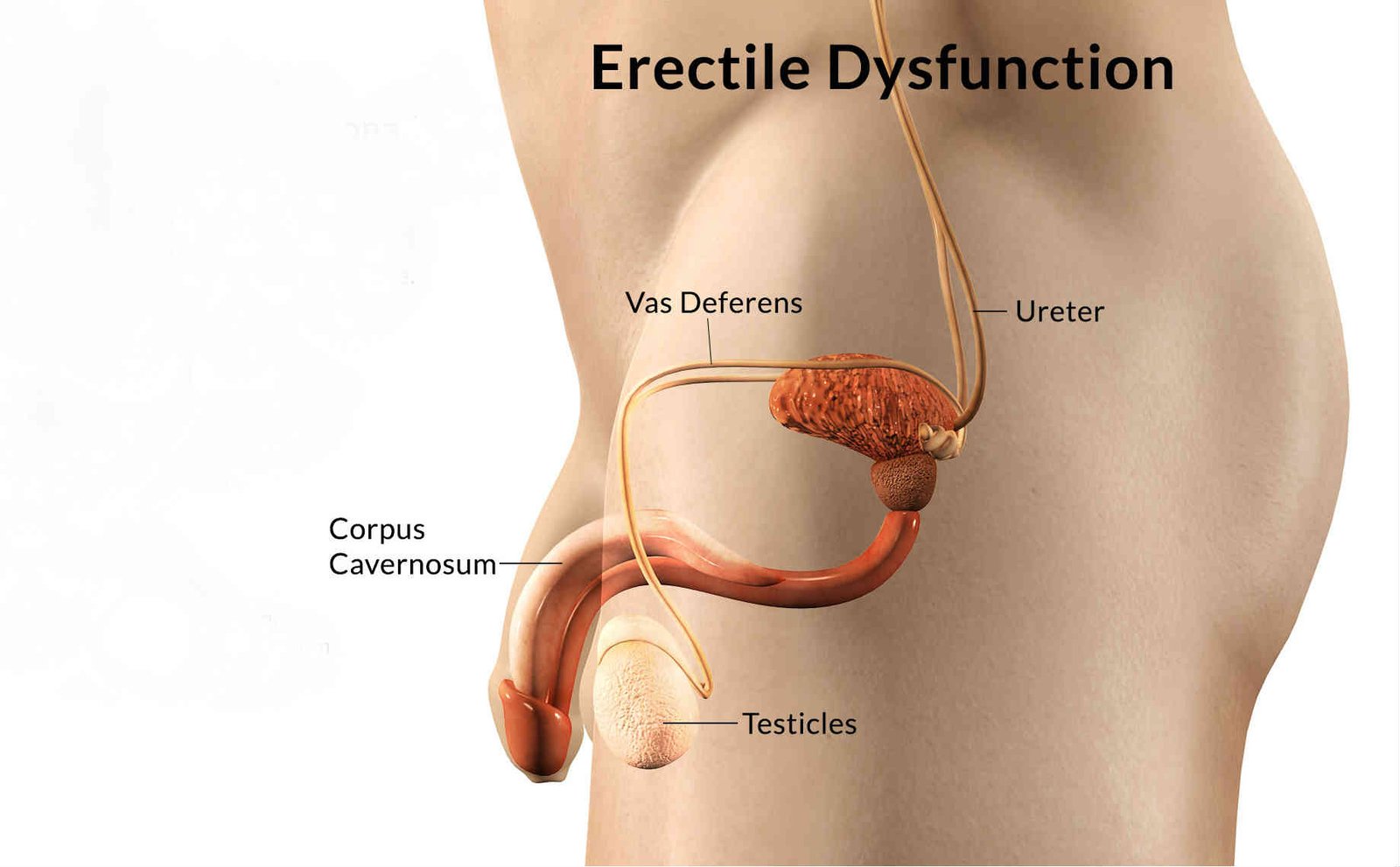 Erectile Dysfunction Treatment in Vaishali